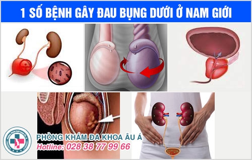 đau bụng dưới ở nam