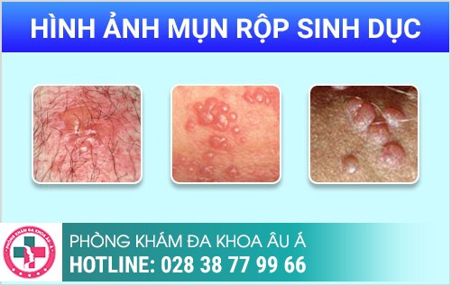 HÌNH ẢNH BỆNH NGOẠI KHOA NAM THƯỜNG GẶP