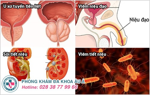 Tiểu ra máu ở nam và những cảnh báo nguy hiểm khó lường