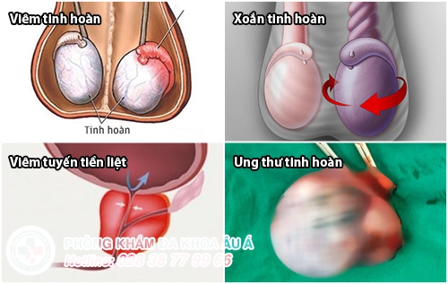 đau tinh hoàn