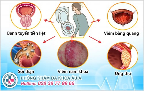 Đi giải ra máu ở nam và nữ cảnh báo điều gì? Có nguy hiểm không?