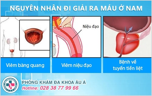 Đi giải đau, có máu là bệnh gì? Có nguy hiểm không?