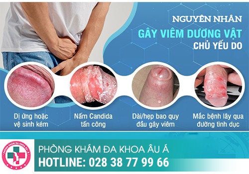 Cách chữa lở loét vùng kín nam hiệu quả