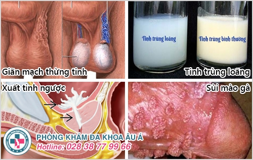 Vô sinh hiếm muộn, nguyên nhân do đâu?