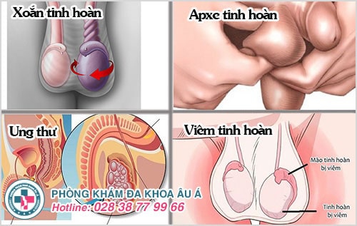 nhức tinh hoàn