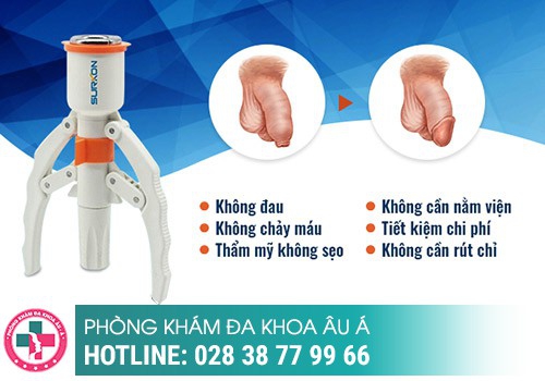 Chi phí cắt bao quy đầu hiện nay là bao nhiêu?