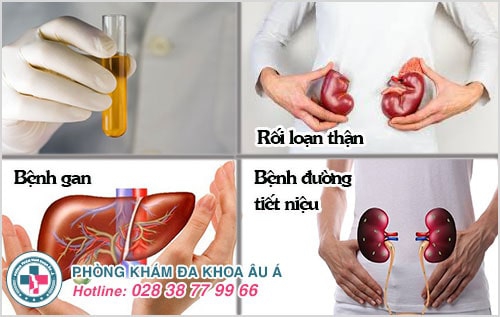 Nước tiểu có màu lạ