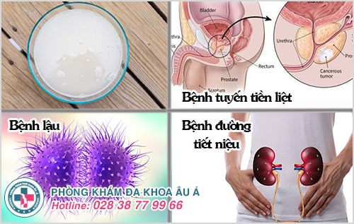 Nước tiểu có màu lạ