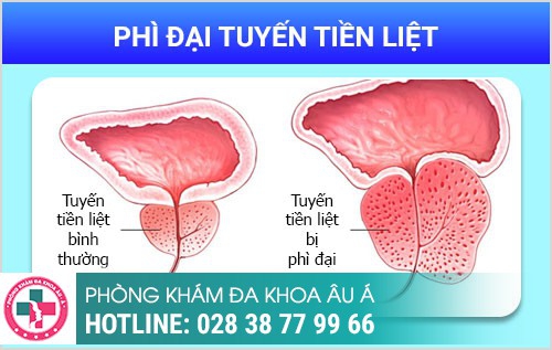 HÌNH ẢNH BỆNH NGOẠI KHOA NAM THƯỜNG GẶP