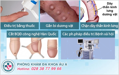 Khám vùng kín nam ở đâu tốt tại TP.HCM?