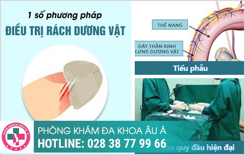 Rách dương vật