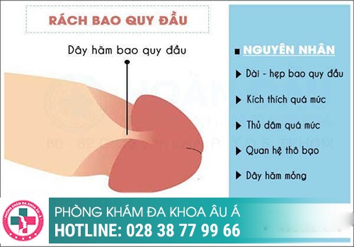 Nguyên nhân bị rách da ở vùng kín nam là gì?