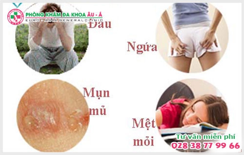 Bệnh rò hậu môn và cách điều trị hiệu quả  hiện nay chính là PPH và HCPT.