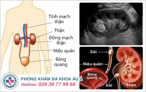 Khám tiết niệu là khám những gì?