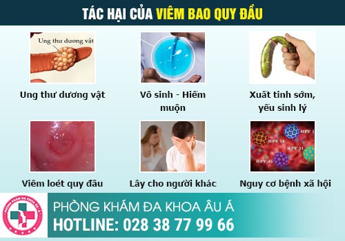 Tác hại của viêm bao quy đầu