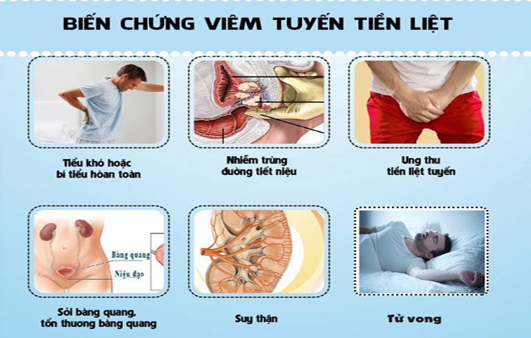 Viêm tuyến tiền liệt và những nguy hại khôn lường