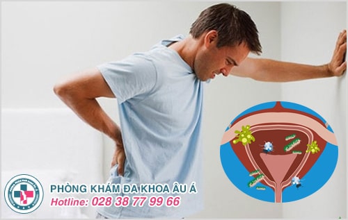 Tiểu rắt là dấu hiệu của bệnh gì?