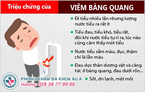 viêm bàng quang