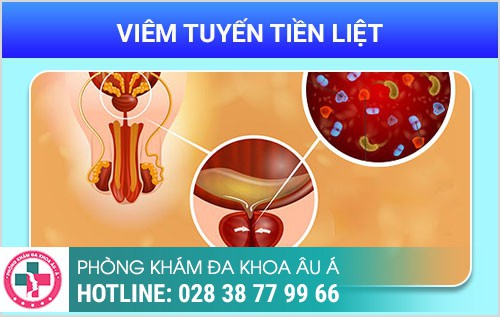 HÌNH ẢNH BỆNH NGOẠI KHOA NAM THƯỜNG GẶP