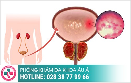 Hình Ảnh bệnh ngoại khoa nam Thường Gặp