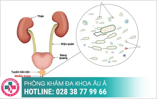 Hình Ảnh bệnh ngoại khoa nam Thường Gặp