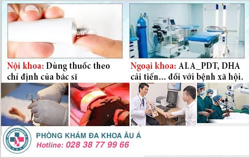 Viêm dương vật