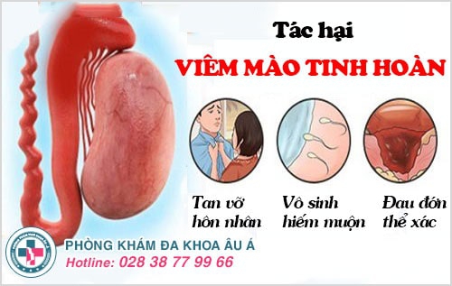 viêm mào tinh hoàn