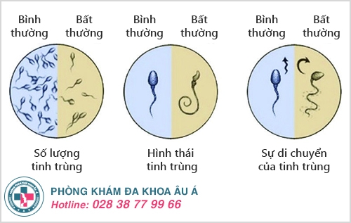 Thông tin cơ bản cần biết về kiểm tra tinh dịch đồ
