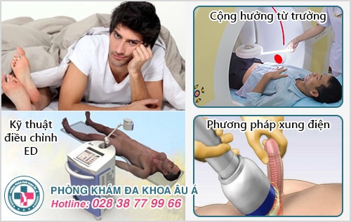 Dấu hiệu liệt dương qua các mức độ dễ nhận thấy nhất Dấu hiệu liệt dương qua các mức độ dễ nhận thấy nhất