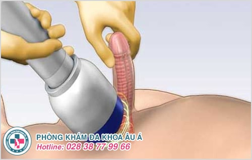 Dương vật không cương cứng, nỗi khổ khiến cả hai mất hứng Dương vật không cương cứng, nỗi khổ khiến cả hai mất hứng