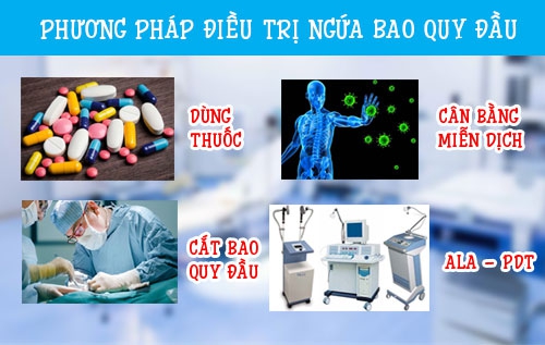Tổng quan về hiện tượng ngứa bao quy đầu nam giới - cần lưu ý!